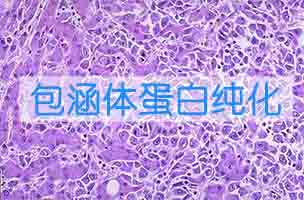 容纳体卵白纯化和复性