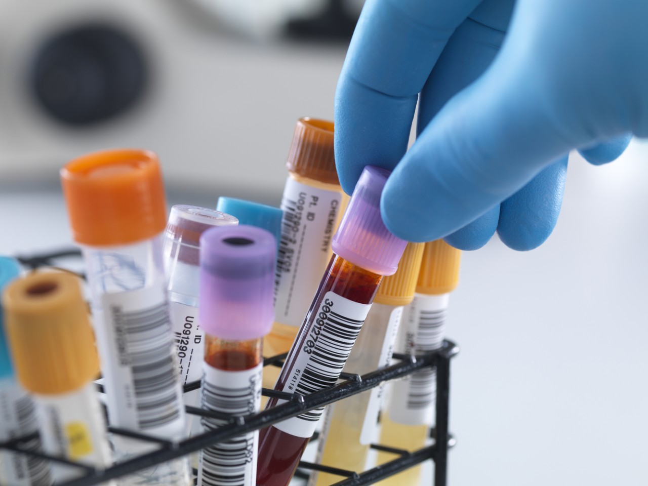 一致性评价大幕开启，，，，，，，，医院市场即将调解