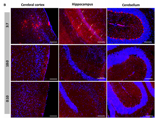 被包裹在含有NT-类脂质的LNP中的Cre重组酶乐成转移。。。。。。。大脑中的转染神经元呈红色高亮。。。。。。。