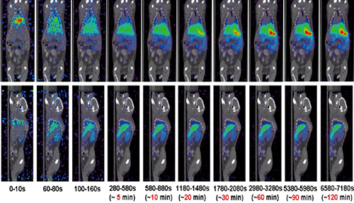 威客电竞PET/CT分子影像手艺平台