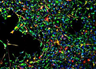 天下首创：药物将干细胞指导至受损部位，，，，，，提高其愈合能力！