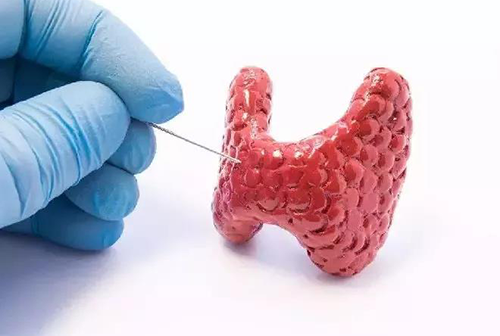 甲状腺疾。。。。。。，，，，包括甲状腺功效减退和甲状腺功效亢进，，，，，自古以来就是重复被医学研究职员研究的疾病