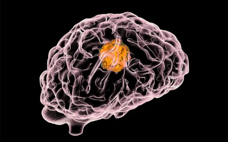 威客电竞助力 | 璧辰医药ABM-1310获美国FDA孤儿药资格认证，，，，，，用于治疗携带BRAF V600突变的脑胶质母细胞瘤患者